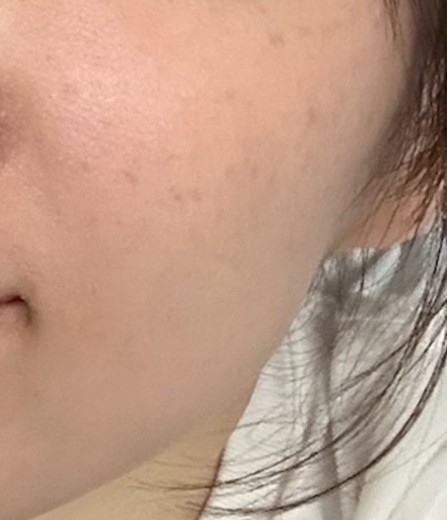 before photo: ルメッカ