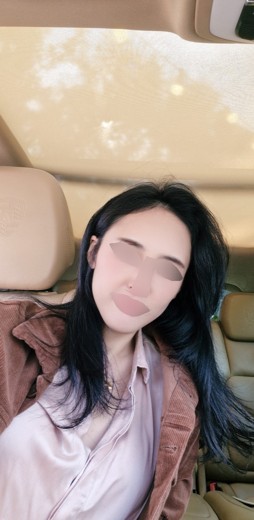 before photo: 쥬베룩