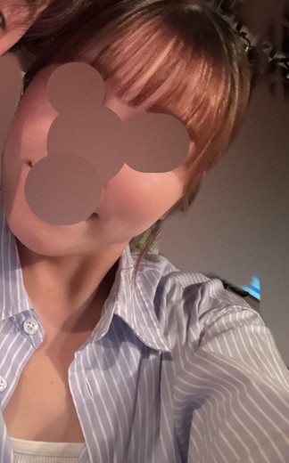 before photo: チタニウムリフト
