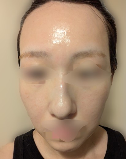 after photo: ルメッカ