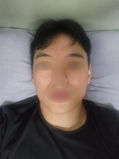 after photo: 슈링크유니버스