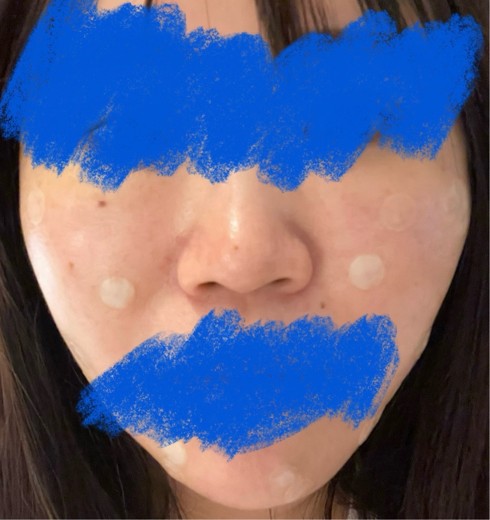 after photo: ポテンツァ(POTENZA)