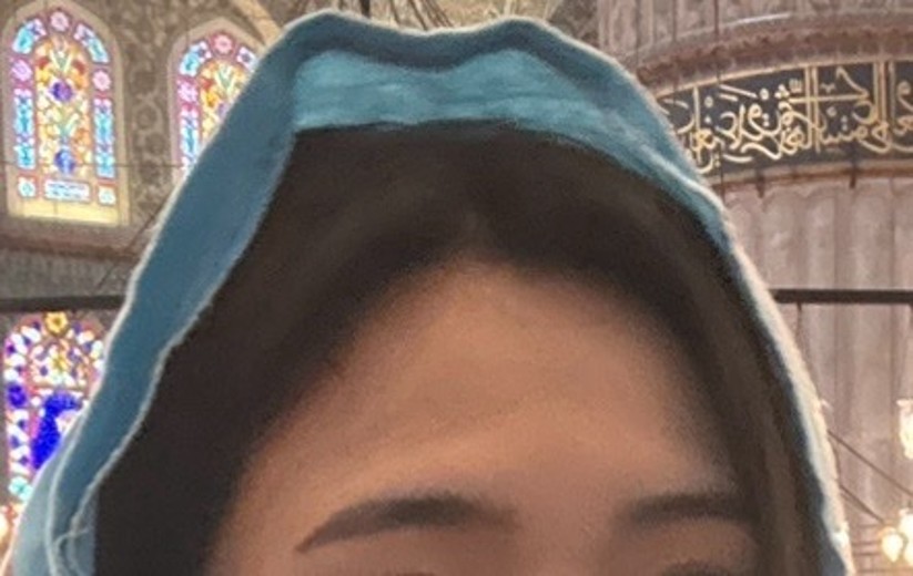 before photo: 이마필러