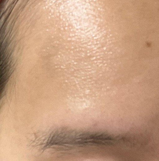 after photo: ルメッカ