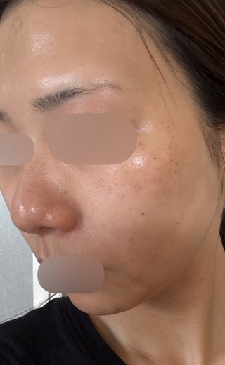 after photo: ルメッカ