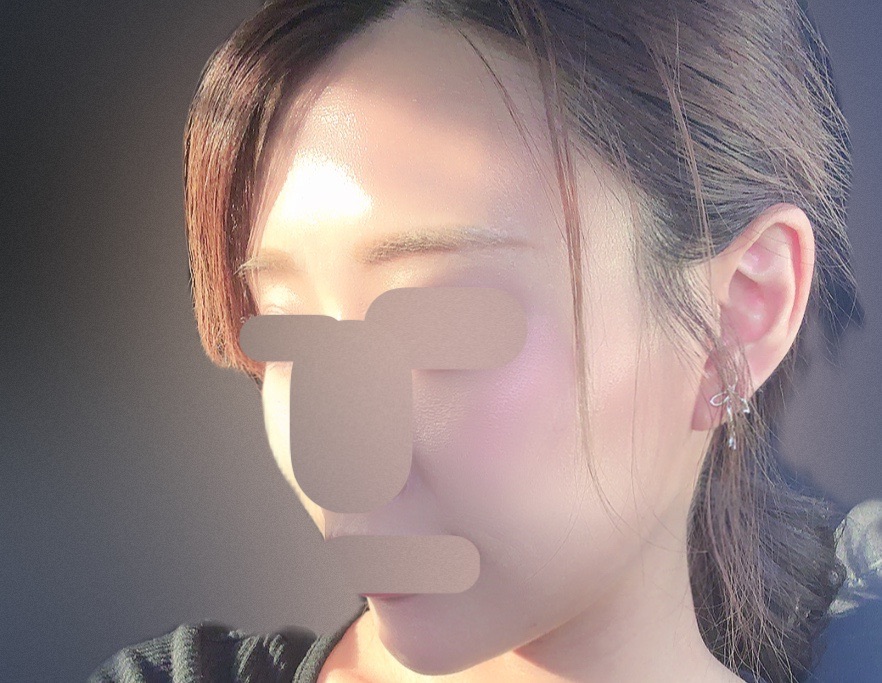 ピンクインティメイト｜選べる3部位 | LIFIX BEAUTY CLINIC