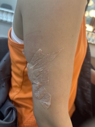 before photo: 脂肪溶解注射(腹部), 脂肪溶解注射(腕)