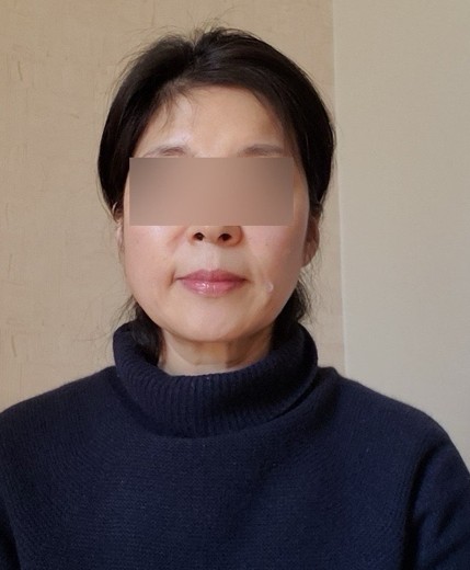 after photo: 쥬베룩