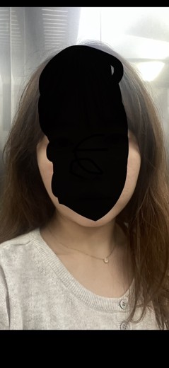 before photo: 윤곽주사, 얼굴지방분해주사