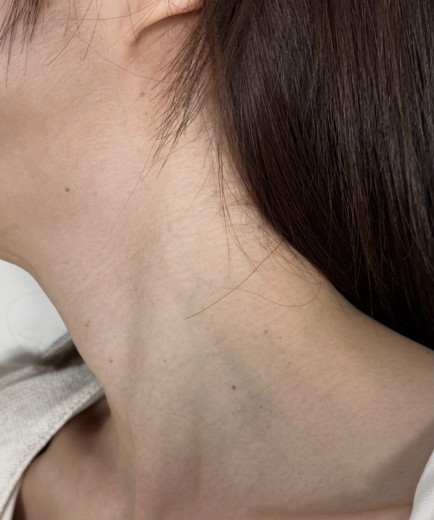 before photo: 착색토닝