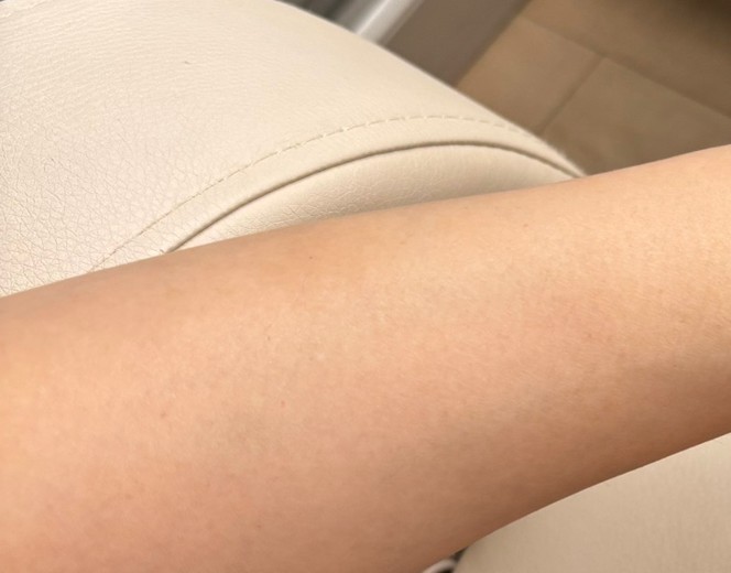 before photo: 白玉注射・点滴