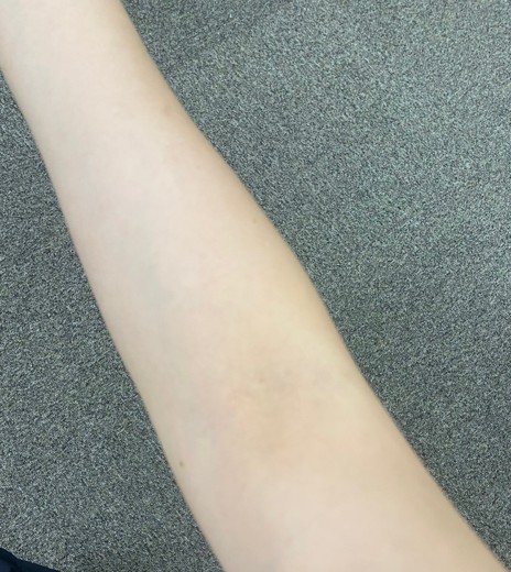 after photo: ダイエット点滴/注射