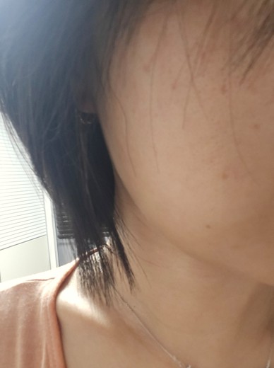 before photo: 쥬베룩