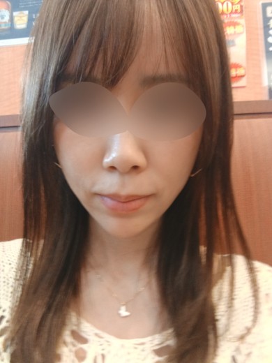 after photo: シルファーム(SYLFIRM)