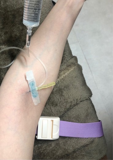 after photo: ビタミン注射・点滴