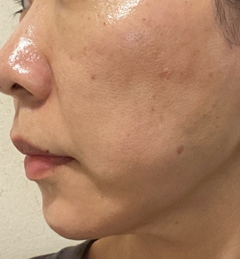 after photo: ルメッカ