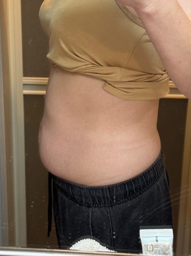 after photo: マンジャロ