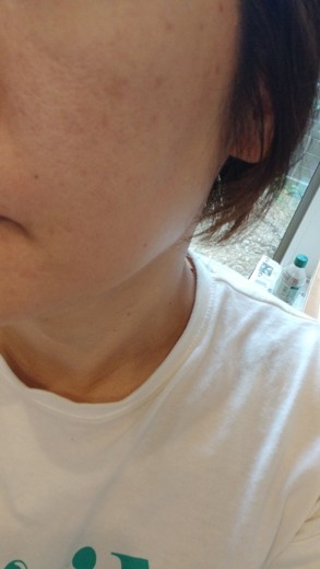 after photo: ポテンツァ(POTENZA), ジュベルック(Juvelook)