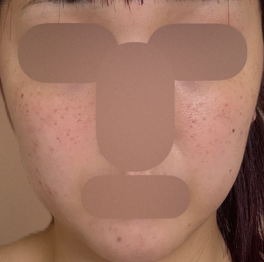 after photo: ルメッカ