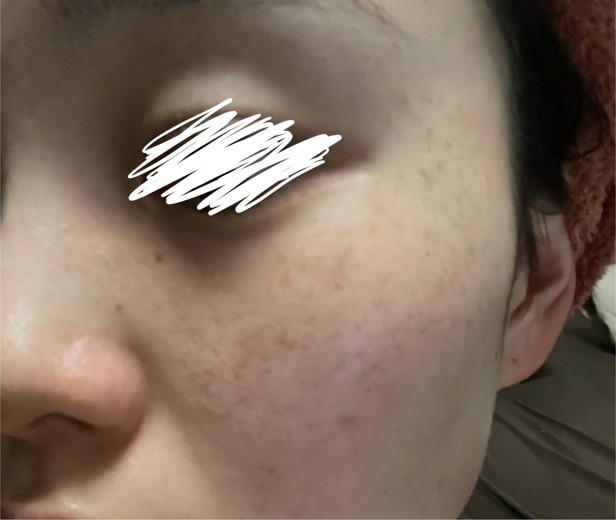 after photo: ルメッカ