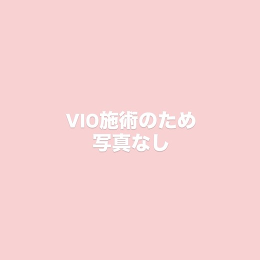 after photo: 脱毛(VIO)