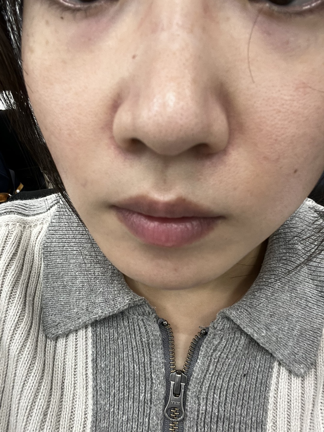 2023年最新エレクトロポレーション　ハイドラフェイシャル 2023年最新エレクトロポレーション ハイドラフェイシャル 2023年最新