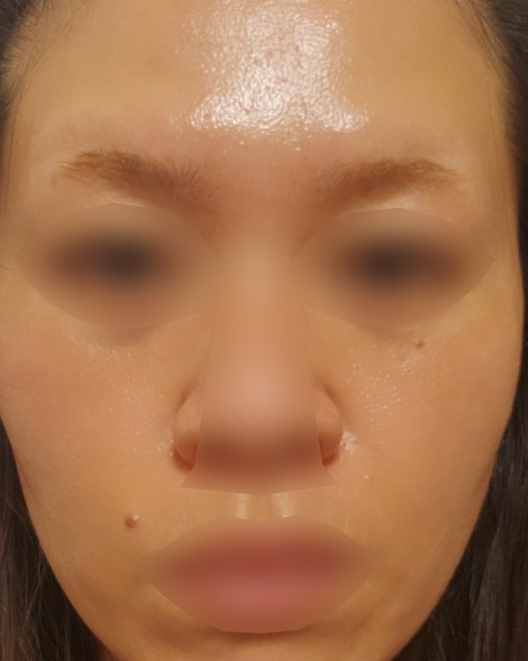 ZX-CLINIC【ゼクスクリニック】の施術口コミ1119件