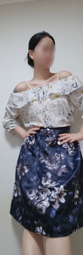 after photo: 복부지방분해주사, 팔지방분해주사