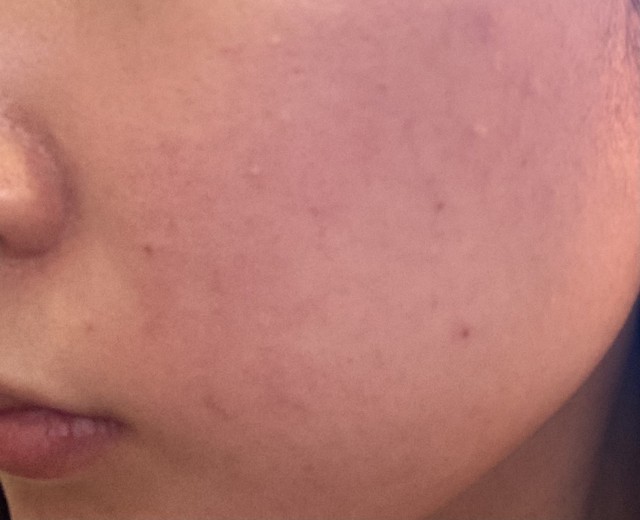 before photo: ルメッカ
