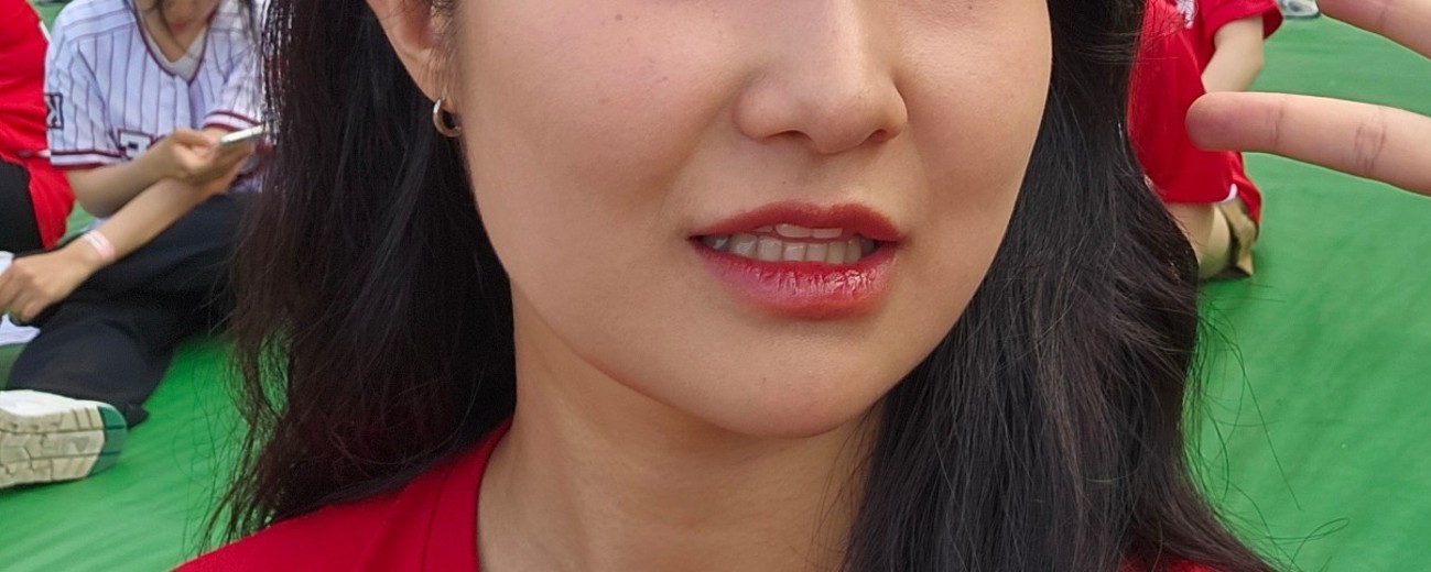 before photo: 팔자주름필러