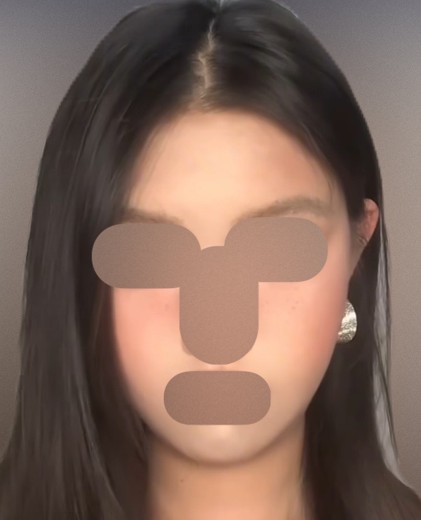 before photo: リジュランヒーラー