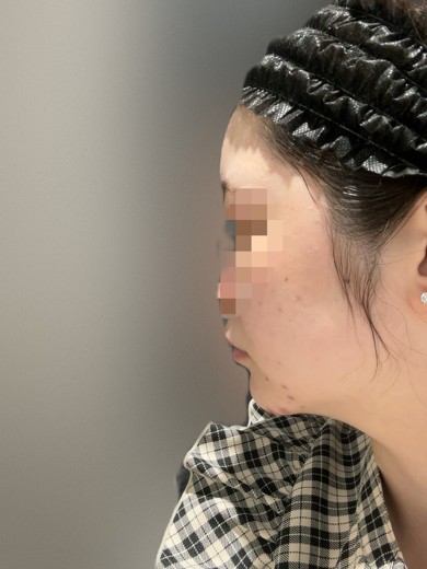 before photo: 診断・検査
