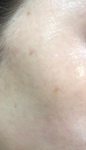 before photo: ルメッカ