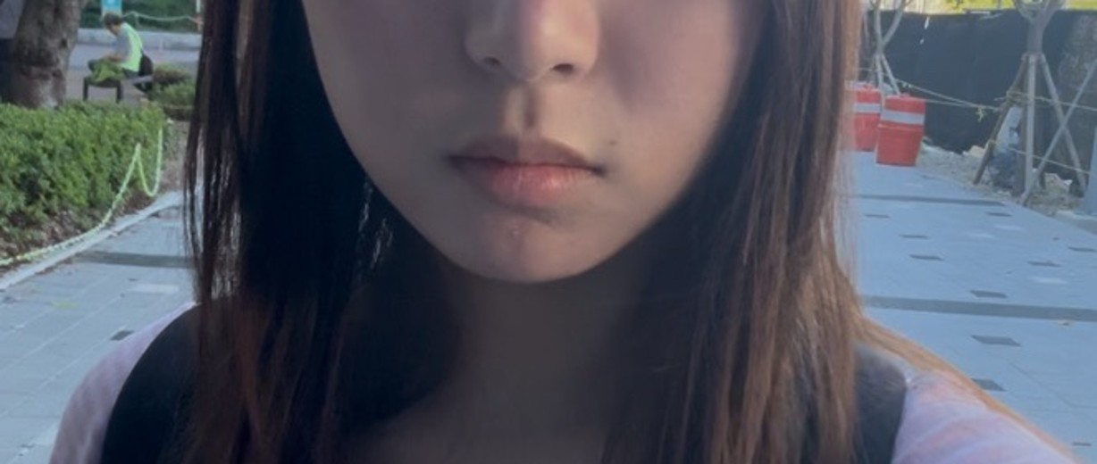 before photo: 입꼬리필러, 입술필러