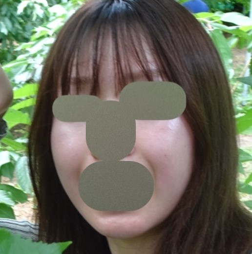 before photo: ウルトラセルZi・リニアZ(ハイフ)