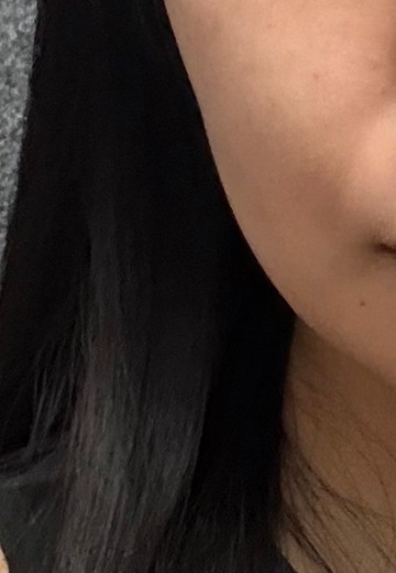 before photo: イオン導入