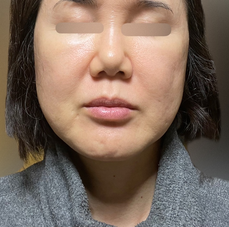 美容マニア様 ZX-CLINIC（ゼクスクリニック） (@zx_clinic2024