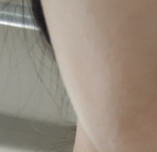 before photo: 옆볼필러