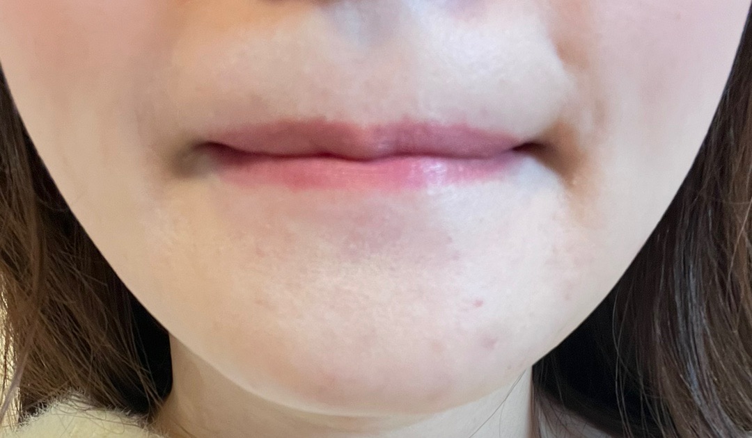 ZX-CLINIC【ゼクスクリニック】の施術口コミ1095件