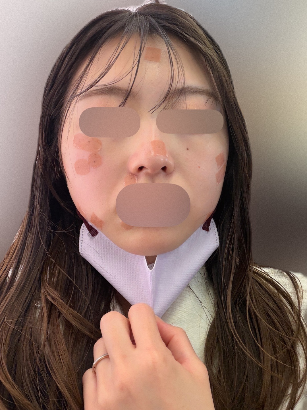 ZX-CLINIC【ゼクスクリニック】の口コミ・料金 | カンナムオンニ