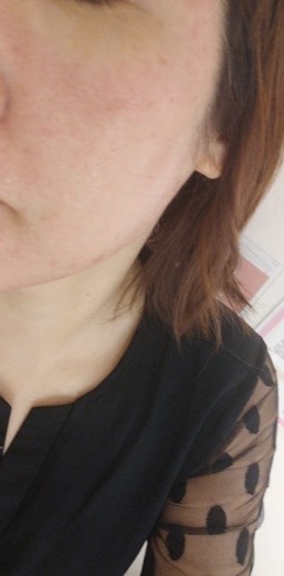 after photo: ポテンツァ(POTENZA), ジュベルック(Juvelook)