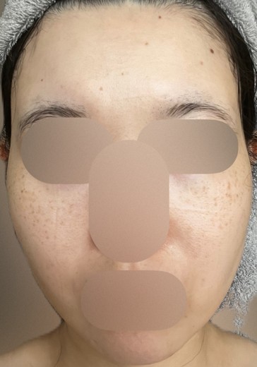 before photo: ルメッカ