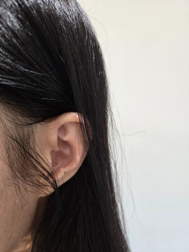 before photo: 귀필러