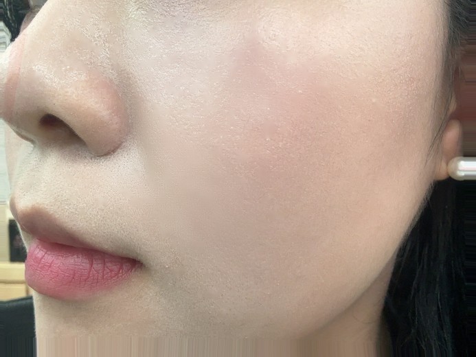 after photo: 쥬베룩