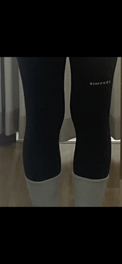 after photo: 종아리보톡스