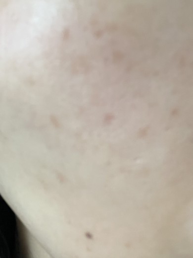 before photo: ルメッカ