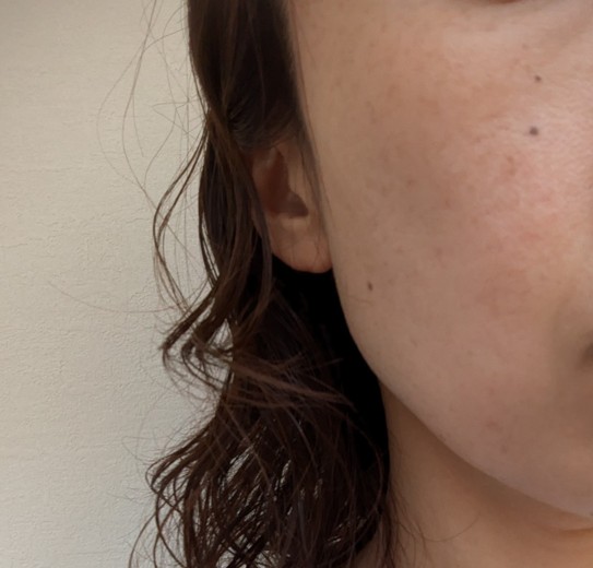after photo: エレクトロポレーション, 診断・検査