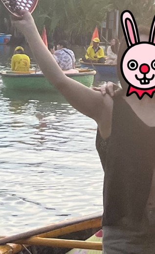 before photo: 팔지방분해주사