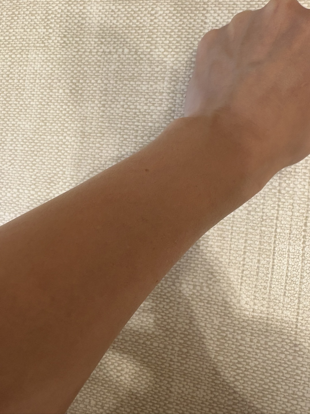 何度でも可】【女性限定】全身脱毛｜ジェントルマックスプロ