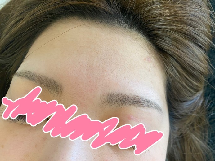 before photo: ポテンツァ(POTENZA)